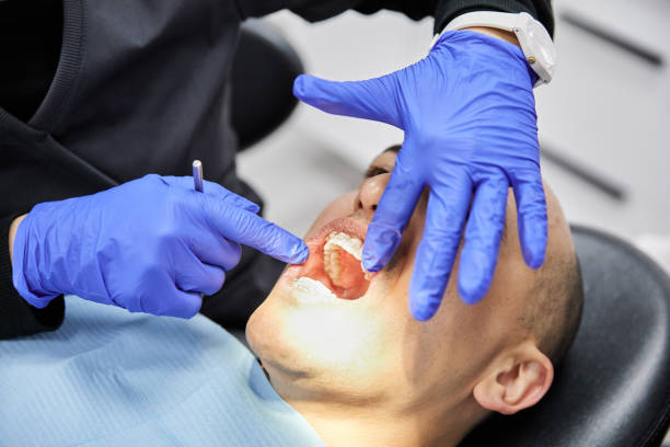Best Emergency Broken Tooth Repair in Soulsbyville, CA